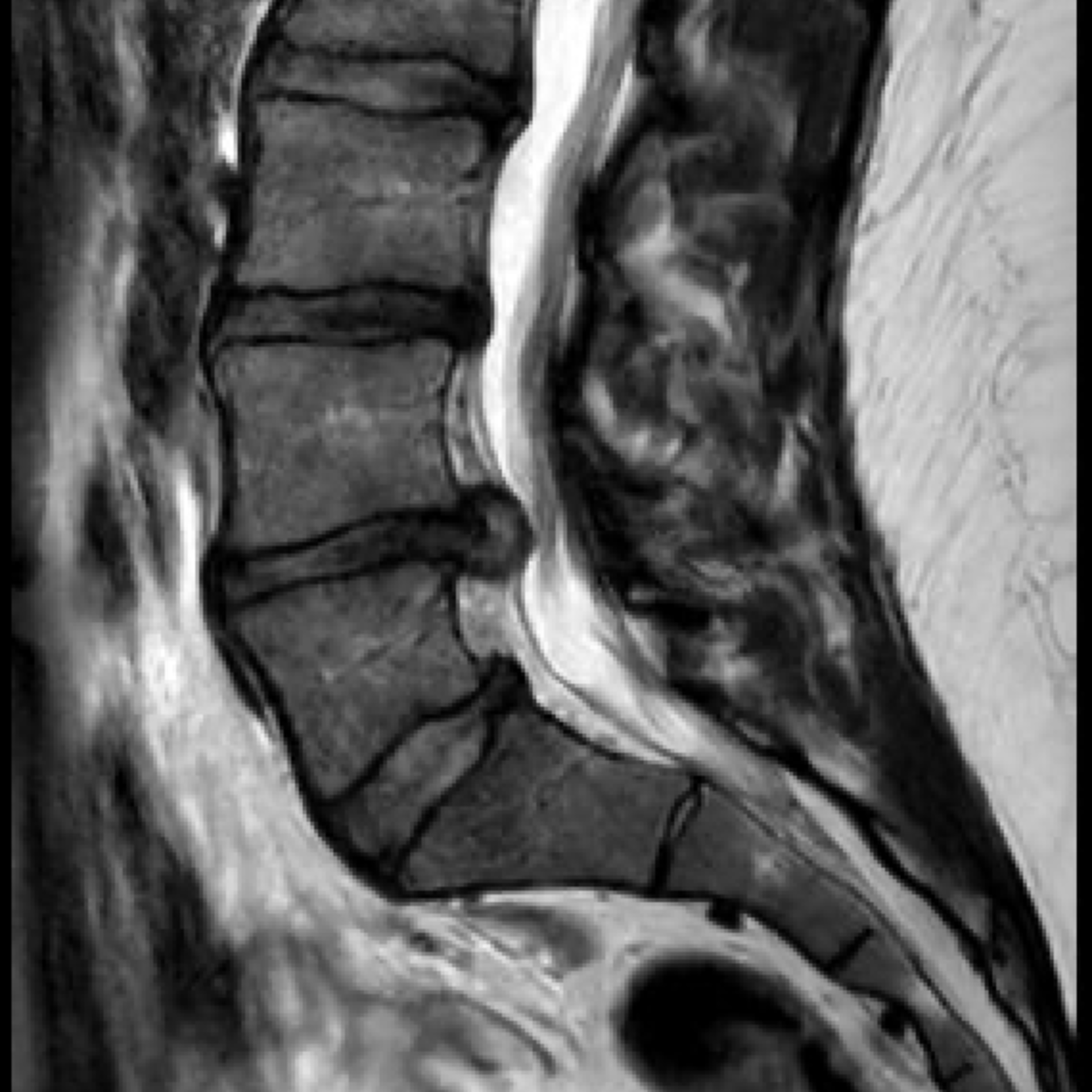 Rug & nek | Orthoclinic - Orthopedie Brugge