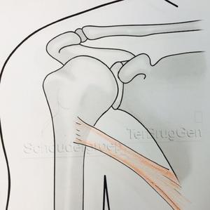 Latissimus dorsi spier